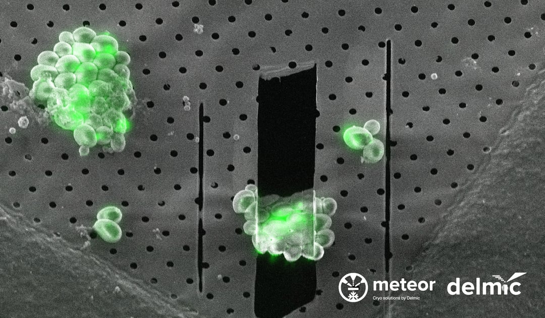 METEOR (fluorescent light microscope) image of a 1 μm thick lamella of yeast overexpressing eGFP-Ede1 with the SEM image overlaid. Images courtesy of A. Bieber, C. Capitanio and O. Schioetz (MPI Biochemistry)
