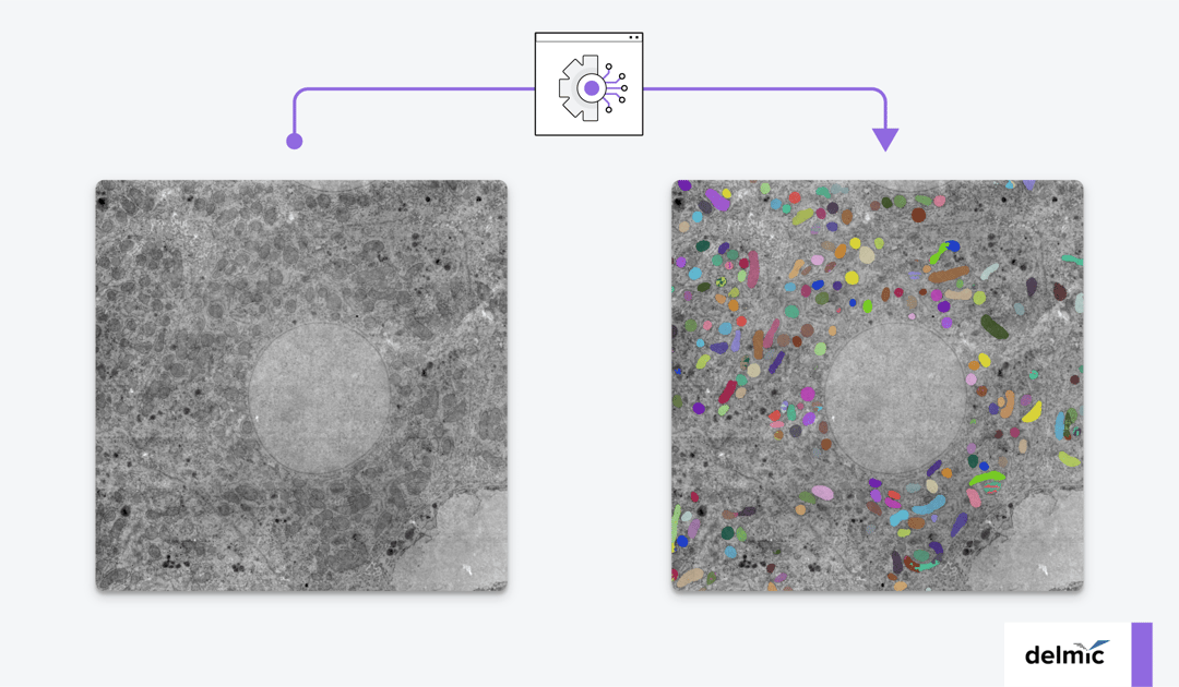 Segmentation of organelles in an electron microscopy image