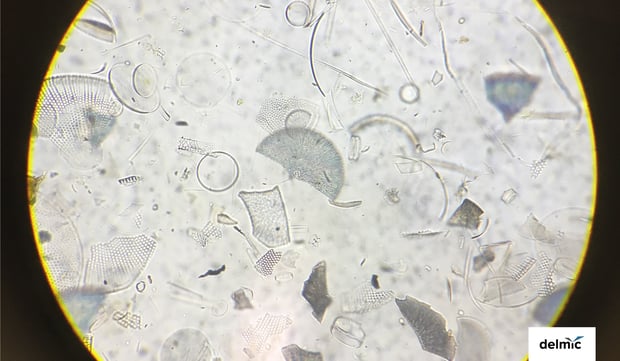 View of microorganisms seen through a microscope