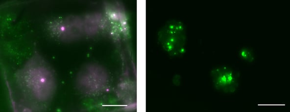 METEOR_HeLa_Yeast_Blogpost_2