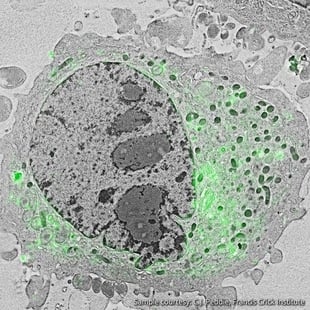 localization of the lipid diacylglycerol within cellular membranes of hela cell