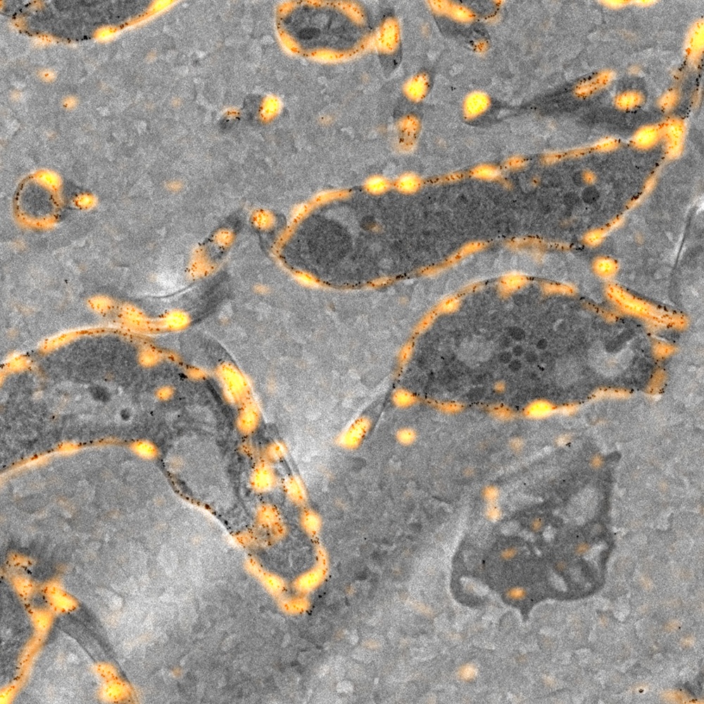 trypanosomes2.jpg