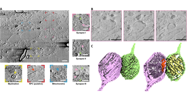 cryo plasma FIB/SEM